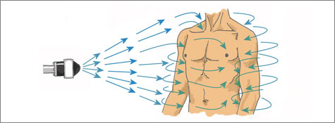 Applying solutions to the human body using ESS spraying systems